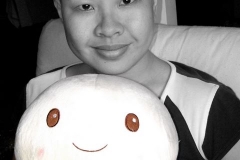 Coming to terms with alopecia areata. Isn't that cute ;-)
